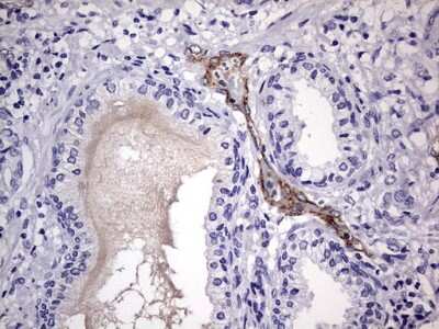Immunohistochemistry: Von Willebrand Factor Antibody (OTI6C7) [NBP2-46358]
