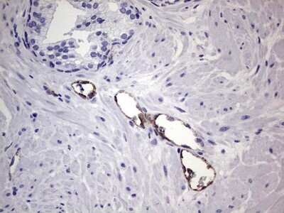 Immunohistochemistry: Von Willebrand Factor Antibody (OTI6C7) [NBP2-46358]