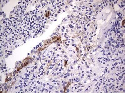Immunohistochemistry: Von Willebrand Factor Antibody (OTI6C7) [NBP2-46358]