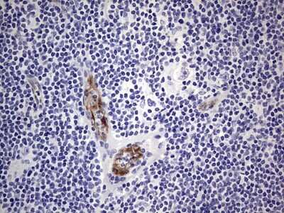 Immunohistochemistry: Von Willebrand Factor Antibody (OTI6C7) [NBP2-46358]