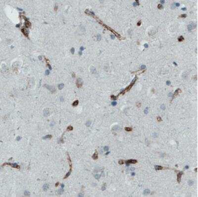 Immunohistochemistry-Paraffin: Von Willebrand Factor Antibody (CL1950) [NBP2-34474]