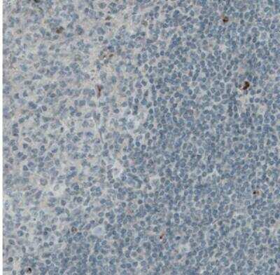 Immunohistochemistry-Paraffin: Von Willebrand Factor Antibody (CL1950) [NBP2-34474]