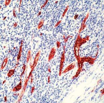 Immunohistochemistry: Von Willebrand Factor Antibody [NB600-586]