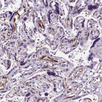 Immunohistochemistry-Paraffin: Von Willebrand Factor Antibody [NBP1-84761]