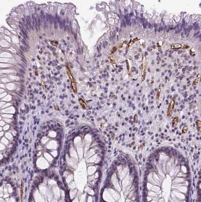 Immunohistochemistry-Paraffin: Von Willebrand Factor Antibody [NBP1-84761]