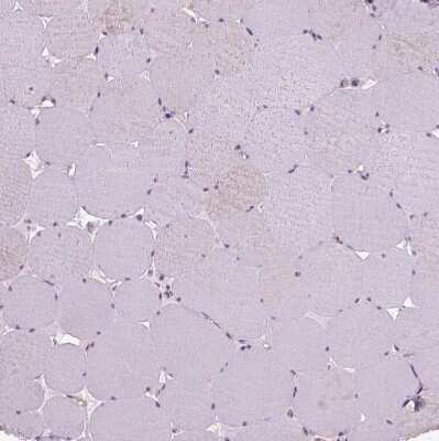 Immunohistochemistry-Paraffin: Von Willebrand Factor Antibody [NBP1-84761]