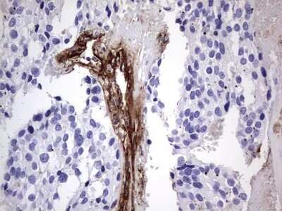 Immunohistochemistry: Von Willebrand Factor Antibody (OTI6C7) - Azide and BSA Free [NBP2-74852]