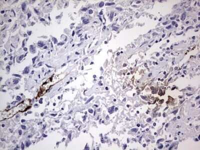 Immunohistochemistry: Von Willebrand Factor Antibody (OTI6C7) - Azide and BSA Free [NBP2-74852]
