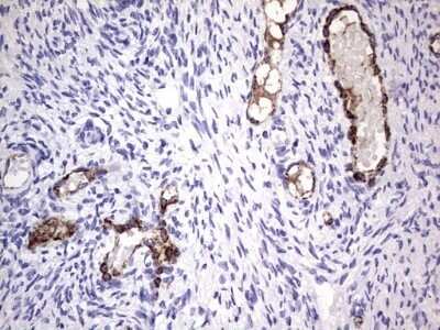 Immunohistochemistry: Von Willebrand Factor Antibody (OTI6C7) - Azide and BSA Free [NBP2-74852]