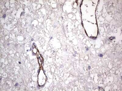 Immunohistochemistry: Von Willebrand Factor Antibody (OTI6C7) - Azide and BSA Free [NBP2-74852]