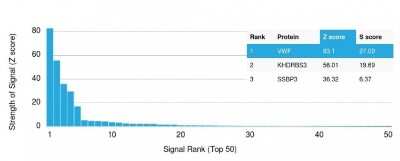 Protein Array: Von Willebrand Factor Antibody (VWF/1465) [NBP2-53314]