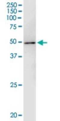 Immunoprecipitation: WAPL Antibody (2B3) [H00023063-M02]