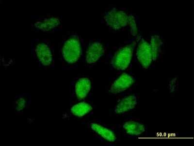 Immunocytochemistry/ Immunofluorescence: WAPL Antibody [H00023063-B01P]