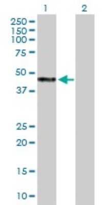 Western Blot: WAPL Antibody [H00023063-B01P]