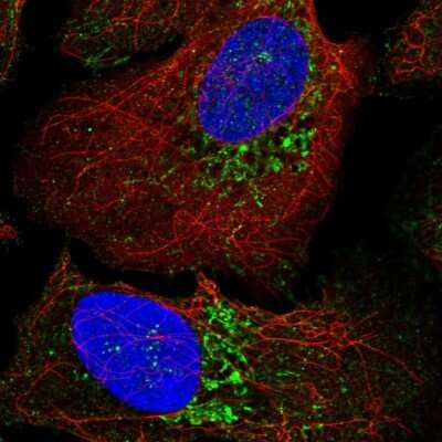 Immunocytochemistry/ Immunofluorescence: WARS2 Antibody [NBP2-57679]