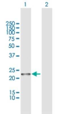 Western Blot: WARS2 Antibody [H00010352-D01P]