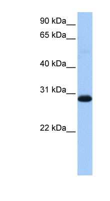 Western Blot: WARS2 Antibody [NBP1-54653]