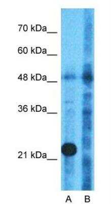 Western Blot: WARS2 Antibody [NBP1-54653]