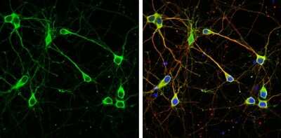 Immunocytochemistry/ Immunofluorescence: WASF1/WAVE1 Antibody [NBP3-13180]