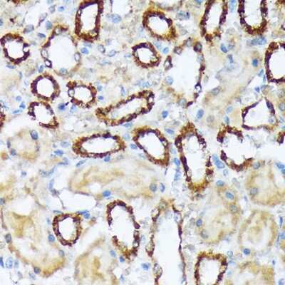 Immunohistochemistry-Paraffin: WASF2 Antibody (7A6C10) [NBP3-15806]