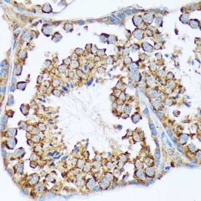 Immunohistochemistry-Paraffin: WASF2 Antibody (7A6C10) [NBP3-15806]