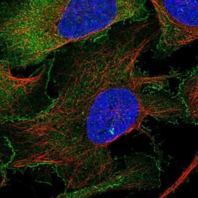 Immunocytochemistry/ Immunofluorescence: WASF2 Antibody [NBP2-37912]