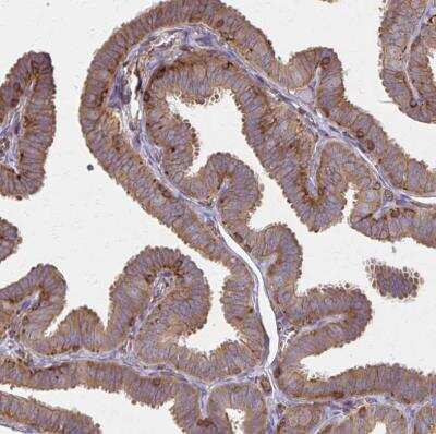 Immunohistochemistry-Paraffin: WASF2 Antibody [NBP2-37912]