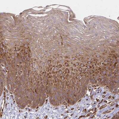 Immunohistochemistry-Paraffin: WASF2 Antibody [NBP2-37912]