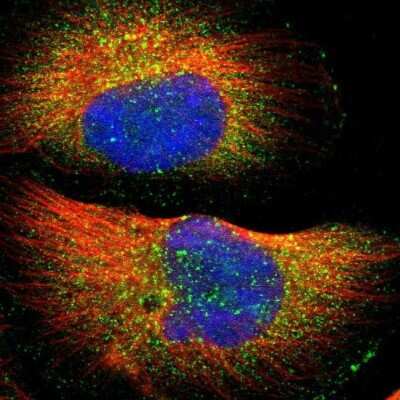 Immunocytochemistry/ Immunofluorescence: WASHC1 Antibody [NBP1-90464]