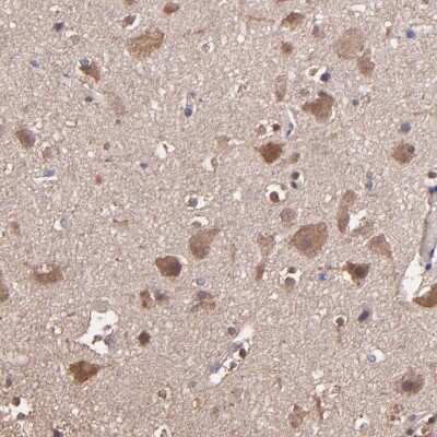 Immunohistochemistry-Paraffin: WASHC1 Antibody [NBP1-90464]