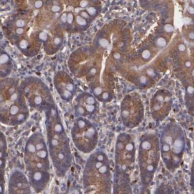 Immunohistochemistry-Paraffin: WASHC1 Antibody [NBP1-90464]