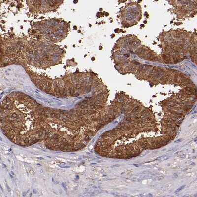 Immunohistochemistry-Paraffin: WASHC1 Antibody [NBP1-90464]
