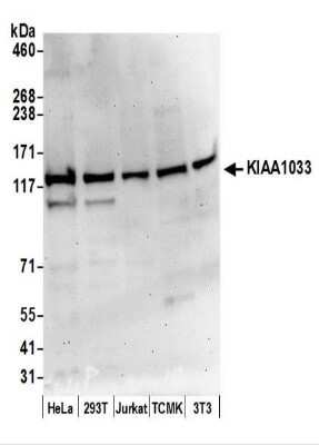 Western Blot: WASHC4 Antibody [NBP2-44291]