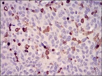 Immunohistochemistry-Paraffin: WASP Antibody (7B10E4) - BSA Free [NBP2-52587]
