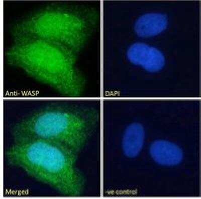 Immunocytochemistry/ Immunofluorescence: WASP Antibody [NB300-996]
