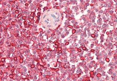 Immunohistochemistry-Paraffin: WASP Antibody [NB300-996]