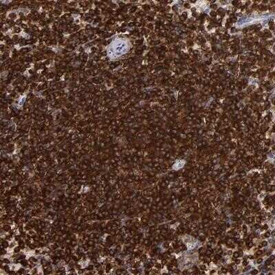 Immunohistochemistry-Paraffin: WASP Antibody [NBP1-87827]