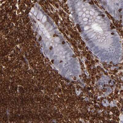 Immunohistochemistry-Paraffin: WASP Antibody [NBP1-87827]