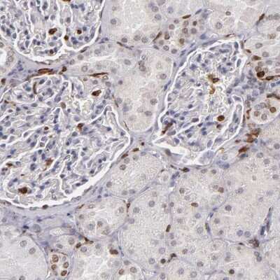 Immunohistochemistry-Paraffin: WASP Antibody [NBP1-87827]