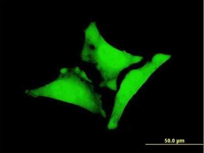 Immunocytochemistry/ Immunofluorescence: WBP1 Antibody (5F6) [H00023559-M06]