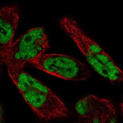 Immunocytochemistry/ Immunofluorescence: WBP11 Antibody [NBP2-58142]