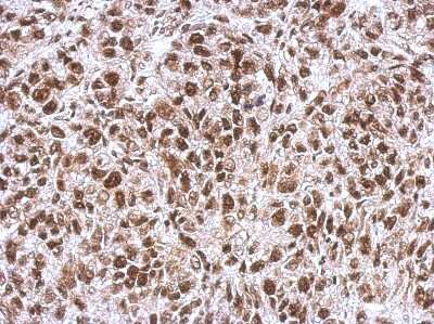 Immunohistochemistry-Paraffin: WBP11 Antibody [NBP2-20886]