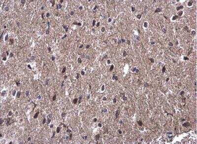 Immunohistochemistry-Paraffin: WBP11 Antibody [NBP2-20886]