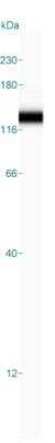 Simple Western: WBP11 Antibody [NBP2-38602]