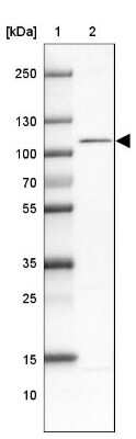 Western Blot: WBP11 Antibody [NBP2-38551]
