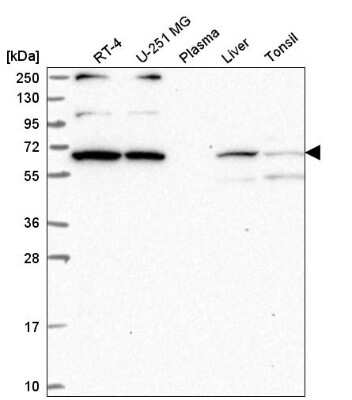 Western Blot: WBP11 Antibody [NBP2-58142]