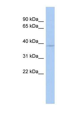 Western Blot: WBP2NL Antibody [NBP1-52897]