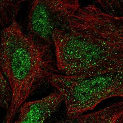 Immunocytochemistry/ Immunofluorescence: WBP4 Antibody [NBP2-55302]