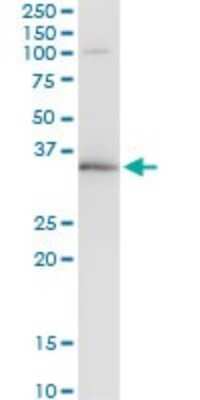 Immunoprecipitation: WBSCR22 Antibody (2E12) [H00114049-M11]
