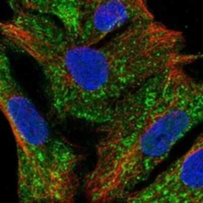 Immunocytochemistry/ Immunofluorescence: WBSCR27 Antibody [NBP3-17558]